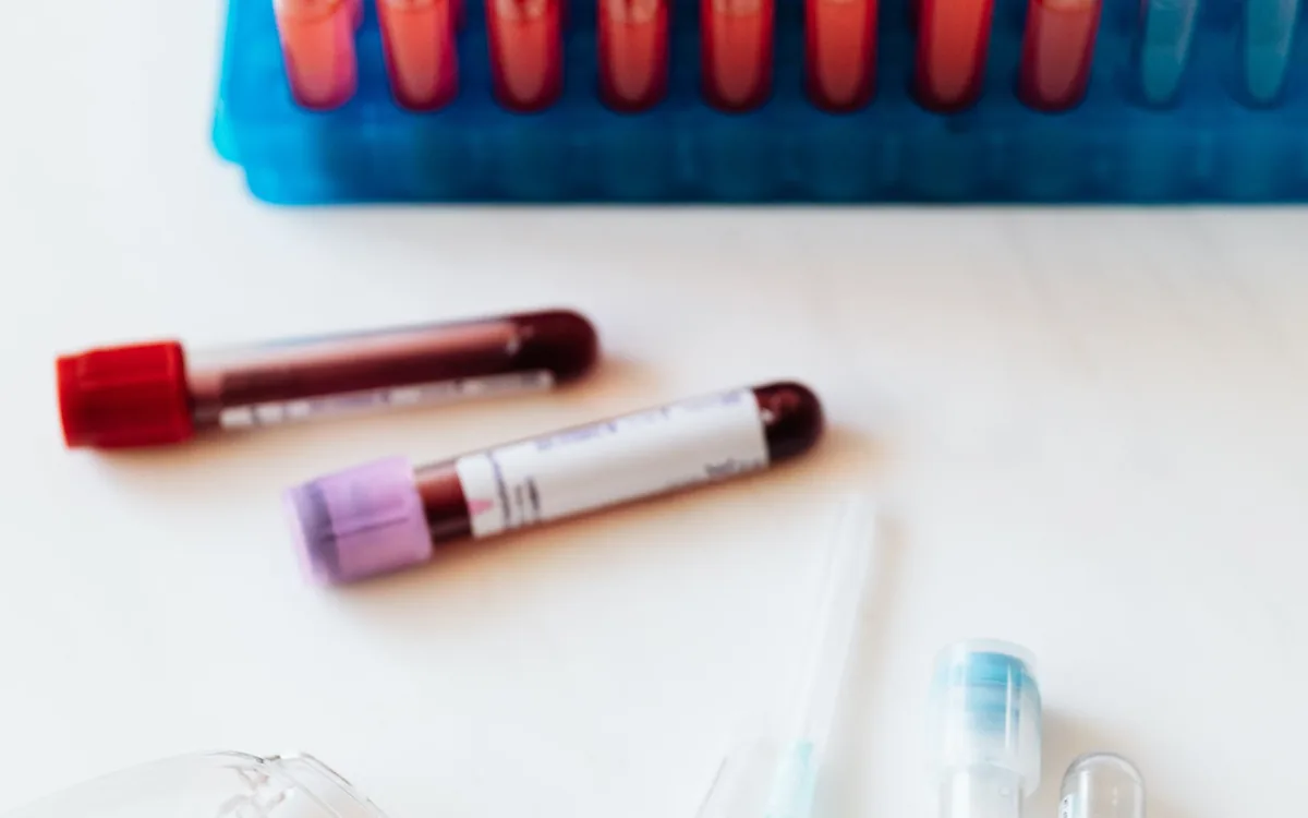 P-Shot (PRP) Nedir, Androlojide Gerçekte Ne Sağlar?