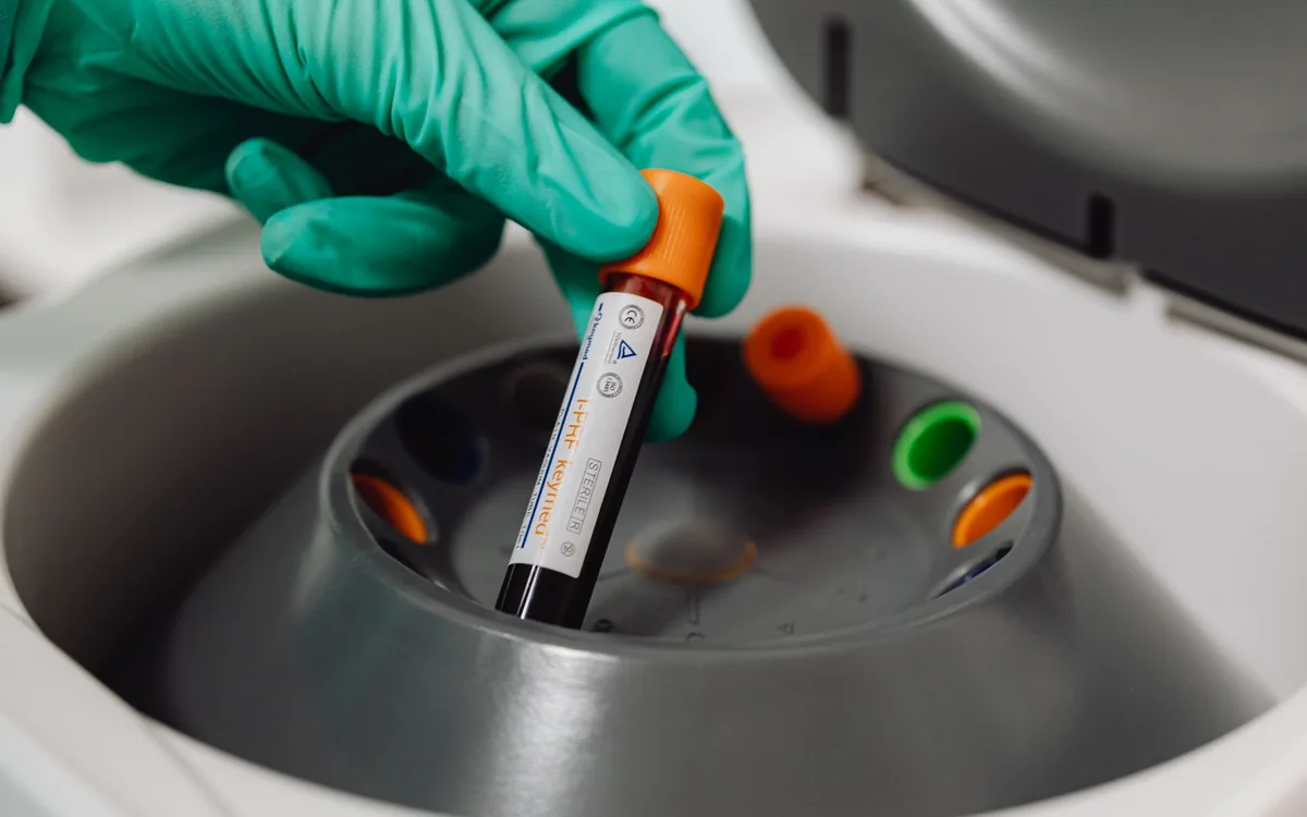 Testosteron Eksikliği (Hipogonadizm): Belirtileri Nelerdir, Nasıl Tedavi Edilir?